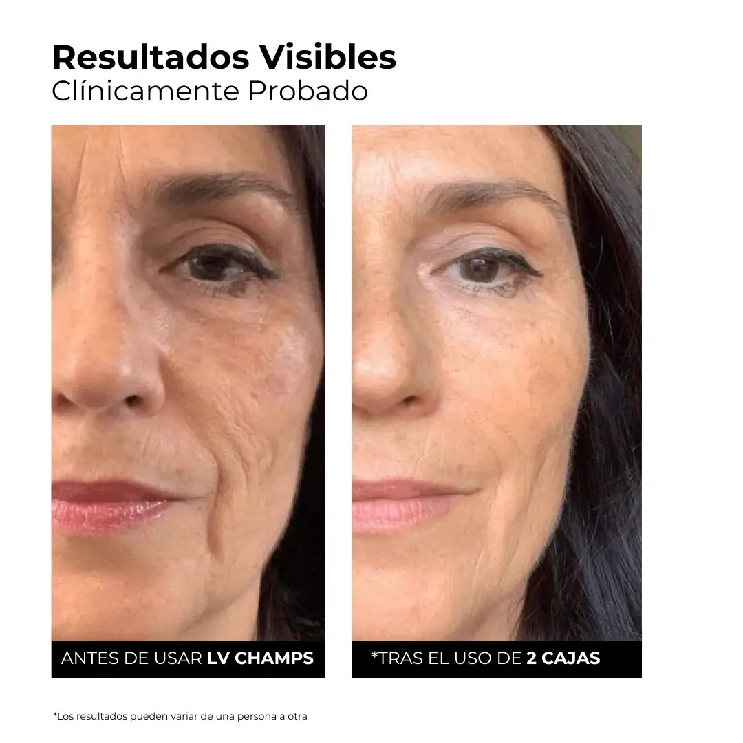 Sérum Hidro-Rellenador 3% Ácido Hialurónico + Péptidos
