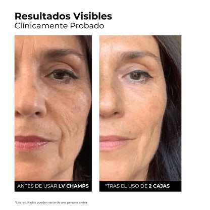 Sérum Hidro-Rellenador 3% Ácido Hialurónico + Péptidos