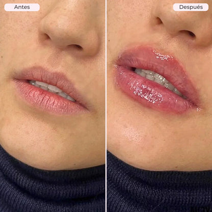 LV CHAMPS LIP PLUMPER