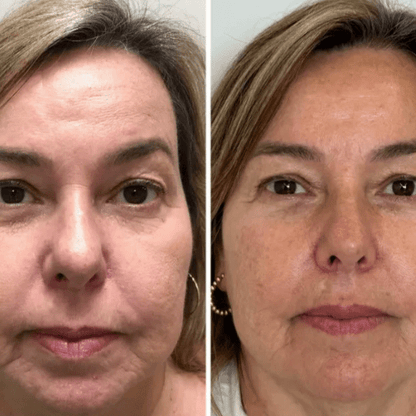 Mascarilla Coreana de Colágeno Rejuvenecedora Peel-Off – Collagen Fit™