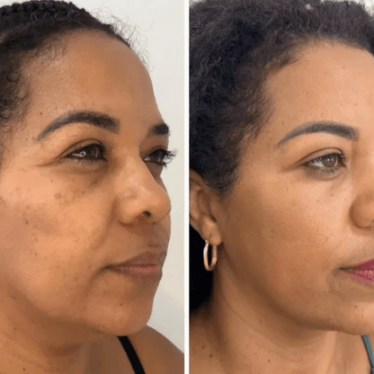Mascarilla Coreana de Colágeno Rejuvenecedora Peel-Off – Collagen Fit™