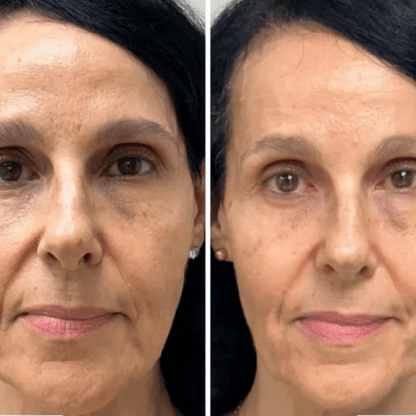 Mascarilla Coreana de Colágeno Rejuvenecedora Peel-Off – Collagen Fit™